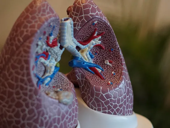 Emphysema Immune Responses May Lead To New Treatments