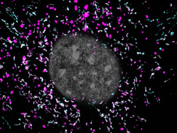 An image of a dysfunctional mitochondria